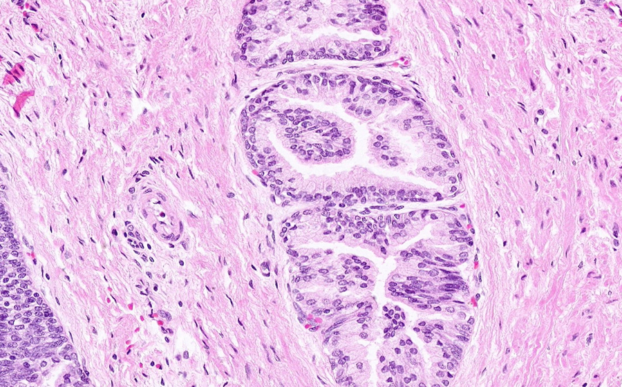 Normal Image 6