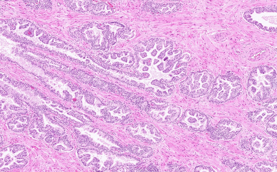 Normal Image 7