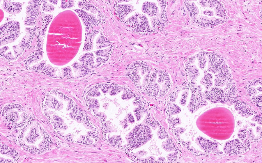 Normal Image 12