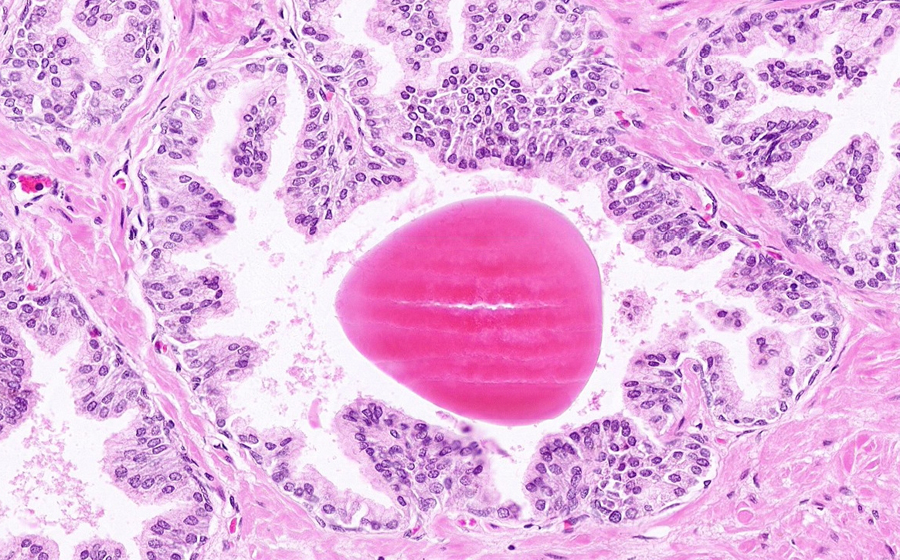 Normal Image 13