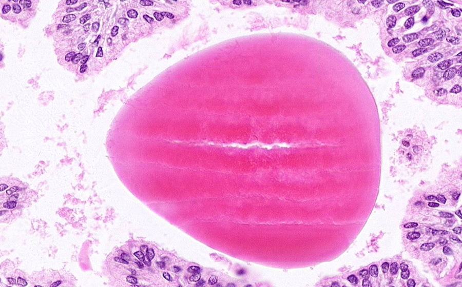 Normal Image 14